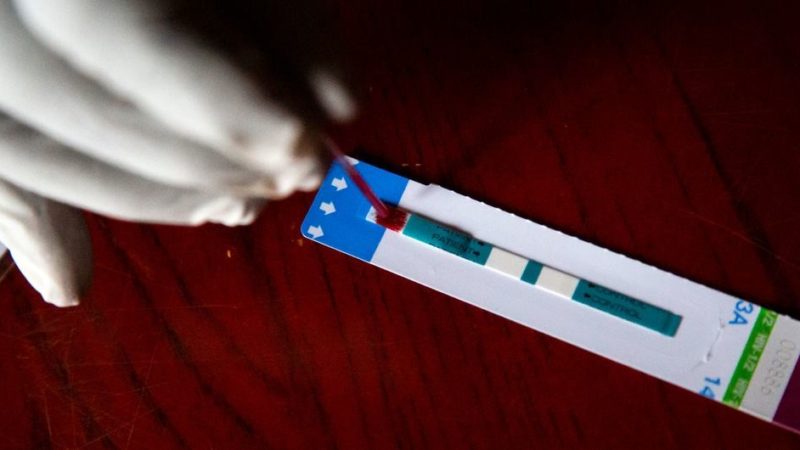 Revelan que existe una variante del VIH más transmisible y dañina