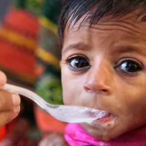 Emaciación grave afecta a más de 600 mil niños y niñas en el mundo que pueden morir por desnutrición: UNICEF