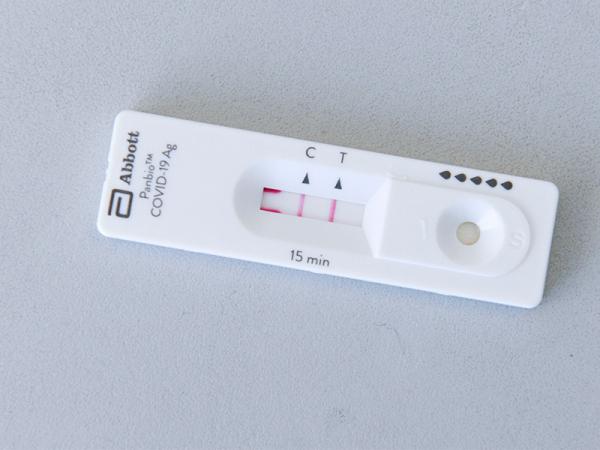 En 24 horas Puebla registra disminución de contagios de SARS-CoV-2: Salud