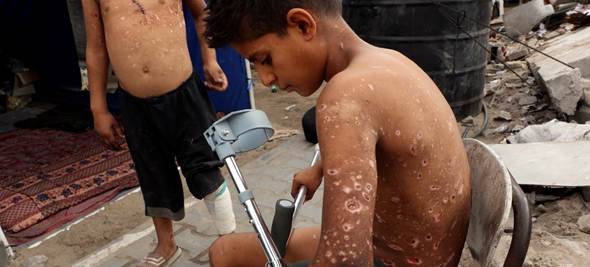 La guerra sigue viva bajo los escombros, persiste el asedio y los ataques en Gaza