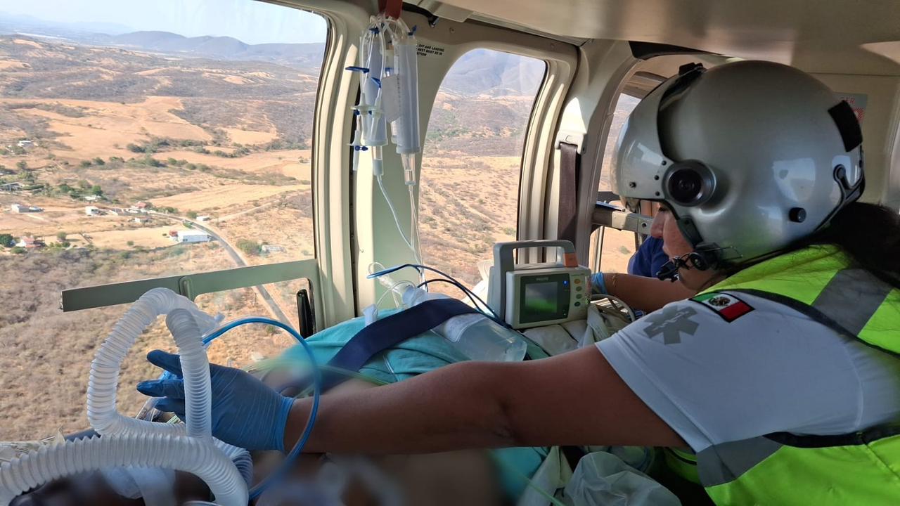 Paciente con quemaduras recibe traslado aéreo desde Chiautla de Tapia
