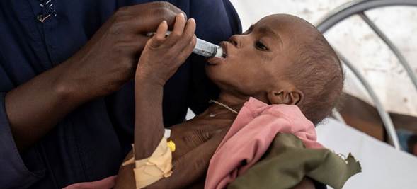 Imagen © UNOCHA/Giles Clarke Una niña de tres años es tratada por desnutrición aguda severa en un hospital de Tawila, en la región de Darfur, Sudán.