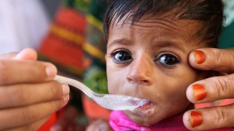 Emaciación grave afecta a más de 600 mil niños y niñas en el mundo que pueden morir por desnutrición: UNICEF