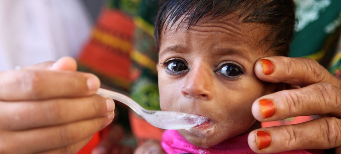 Emaciación grave afecta a más de 600 mil niños y niñas en el mundo que pueden morir por desnutrición: UNICEF