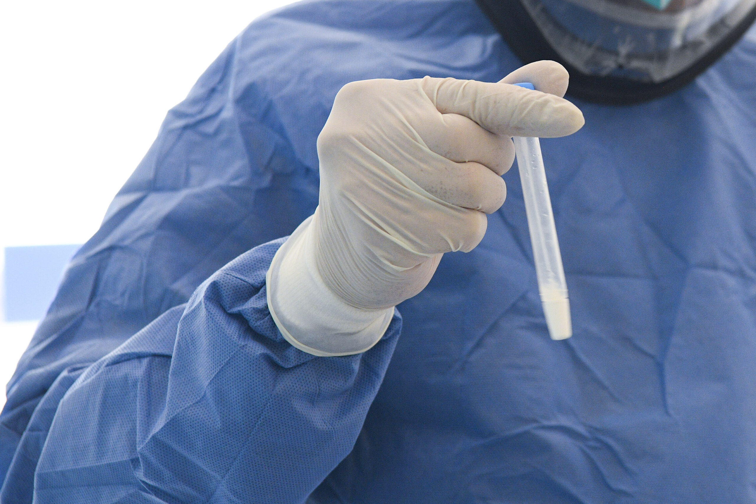 En 24 horas, Puebla registra disminución de contagios de SARS-CoV-2: Salud